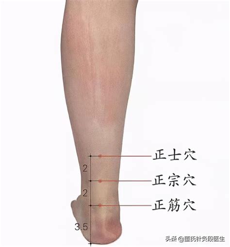 牽正穴|醫砭 » 中華針灸 » 牽正